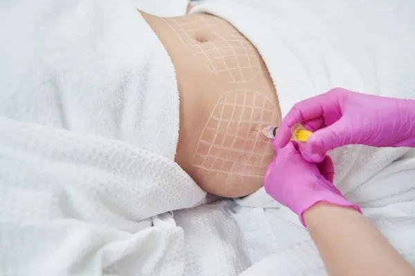 image of fat dissolving injections on love handles to help combat weight gain Dysart